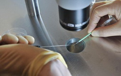 IVF Genetics IVF Genetics