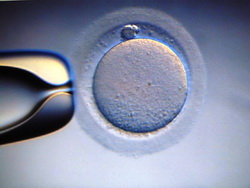 IVF Insurance IVF Insurance