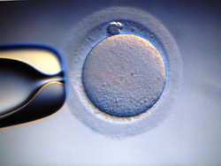 IVF Insurance