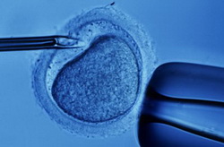 IVF PGD