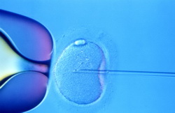 IVF Procedures