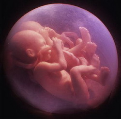 IVF Protocol IVF Protocol
