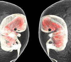 IVF Stimulation IVF Stimulation