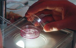 IVF Treatments