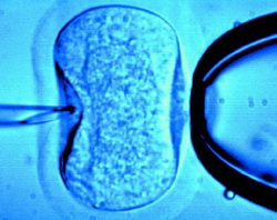 IVF IVF