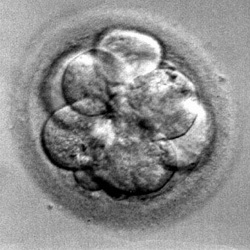 Process IVF Process IVF