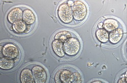 Stimulation IVF Stimulation IVF